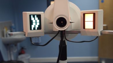 Astigmatismo e chirurgia refrattiva